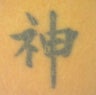 Laser tattoo removal 