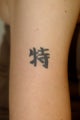 Tattoo Removal