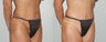 Abdominoplasty