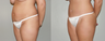 Abdominoplasty