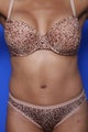 Tummy Tuck