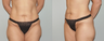 Abdominoplasty
