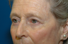 Fat grafting cheeks with ptosis repair and quad bleph