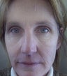 48 year old female patient 