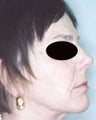 47  year old female patient 