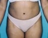 34 year old female patient 