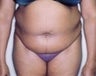 34 year old female patient 