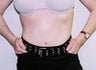37 year old female patient 