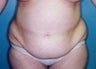 37 year old female patient 