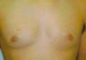 24 year old male patient 