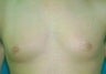 24 year old male patient 