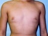 15 year old male patient 