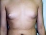 15 year old male patient 