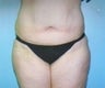 31 year old female patient 