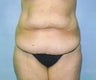 31 year old female patient 