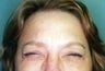 36 year old female patient 