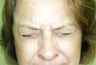 36 year old female patient 
