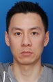 Asian Rhinoplasty