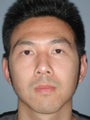 Otoplasty/Ear Surgery