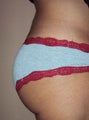 Butt implants