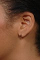 Ear lobe surgery