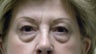 Eyelid Surgery