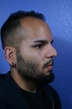 Revision rhinoplasty