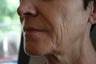 Sculptra
