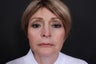 58 year old female, facial fat grafting