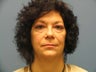 Quicklift w/neck liposuction, Upper and Lower Eyelids, Mixto Laser Resurfacing