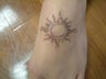Tattoo Removal