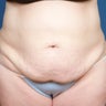 35 - 45 Year Old Female