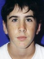 Otoplasty Male - Boy treated by Ear Surgery