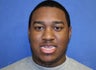 A young man with large underbite treated with Jaw Surgery (Orthognathic Surgery)