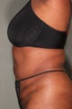55 Year Old Female Treated for Unwanted Fat with SmartLipo  and Vaser Laser & Fat Transfer