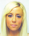 Rhinoplasty