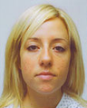 Rhinoplasty