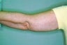 55 year old female patient 