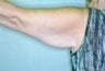 55 year old female patient 