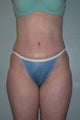 Female patient 