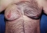 34 year old male patient 