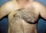 34 year old male patient 