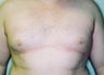 22 year old male 