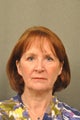 66 year old female treated for sun damage and wrinkles