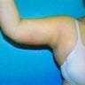 35 year old female patient 