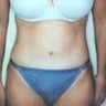 34 year old female patient 