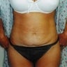 34 year old female patient 