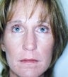 48 year old female patient 