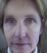 48 year old female patient 