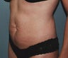 34 year old female patient 